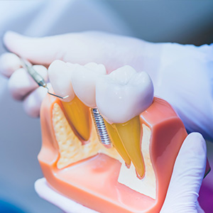 Dental Illuminations | Periodontal Treatment, Cosmetic Dentistry and CEREC reg 