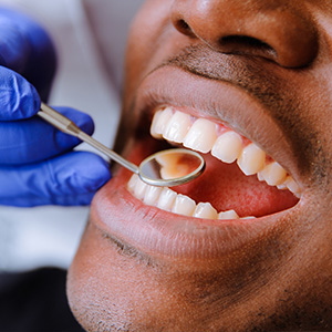 Dental Illuminations | Implant Dentistry, Dentures and Root Canals