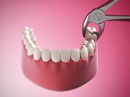 Dental Illuminations