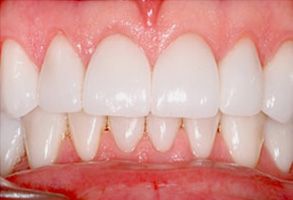 Dental Illuminations | Emergency Treatment, Implant Dentistry and CEREC reg 